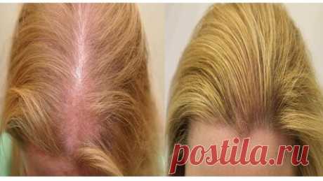 Это натуральное льняное средство укрепит ваши волосы, сделает их более здоровыми и густыми!