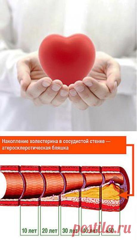 Настоящие причины сердечно-сосудистых заболеваний