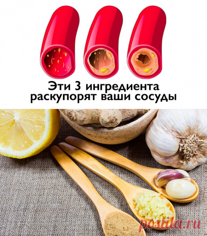 Как очистить ваши сосуды с помощью всего 3-х ингредиентов