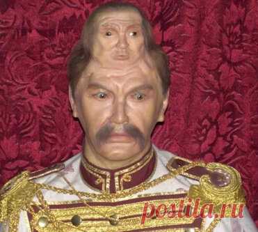 Его считали чадом нечисти. История Паскуаля Пинона, человека с двумя головами