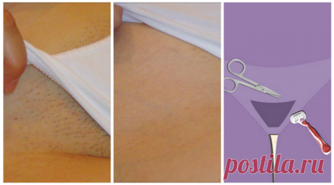 Remove Unwanted Hair Forever In Intimate Parts With This One Ingredient!