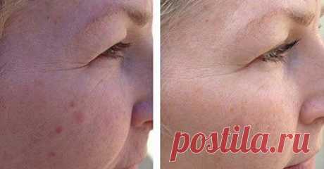 Гладкая и сияющая кожа всего за 5 минут! Средство, творящее чудеса, почти бесплатно… |