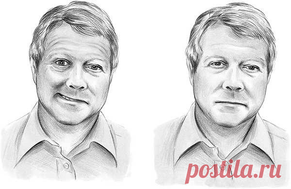 Как убрать асимметрию лица после инсульта.