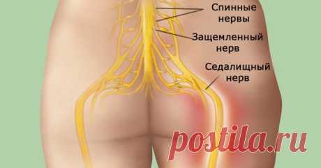Попрощайтесь с болью в спине! Достижение успеха в 95 % случаев!
