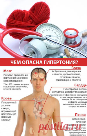 В статье вы узнаете все о повышенном артериальном давлении: причины, симптомы, признаки, а также что делать при повышенном давлении