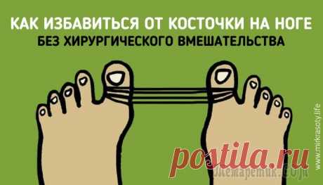 Теперь я знаю, как избавиться от болезненной косточки на ноге!