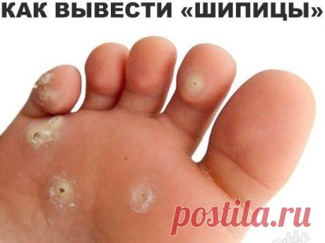 (99) Одноклассники