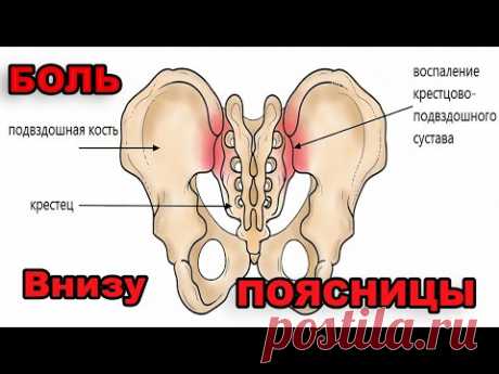 ✔Как разблокировать крестцово-подвздошный сустав?✔