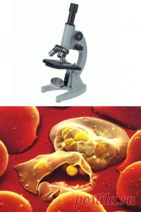 Паразитоз | Квинтэссенция Здоровья