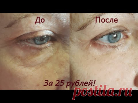 Недорогое аптечное средство для омоложения кожи лица. Бюджетная альтернатива дорогому крему! - YouTube