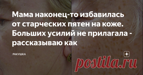 Мама наконец-то избавилась от старческих пятен на коже. Больших усилий не прилагала - рассказываю как Моей маме 58 лет, в ее возрасте это проблема стала очень сильно проявляться, она у меня модница и красавица и ее это напрягало, но не прилагая больших усилий она избавилась от старческих пятен по моей рекомендации