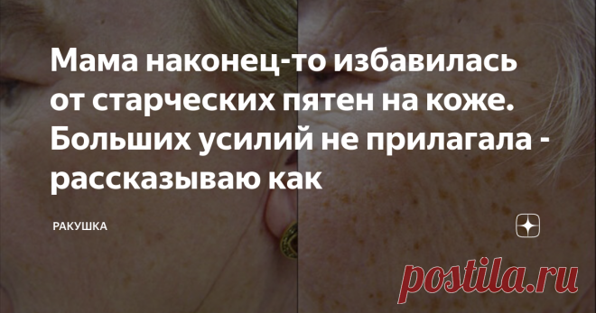 Мама наконец-то избавилась от старческих пятен на коже. Больших усилий не прилагала - рассказываю как Моей маме 58 лет, в ее возрасте это проблема стала очень сильно проявляться, она у меня модница и красавица и ее это напрягало, но не прилагая больших усилий она избавилась от старческих пятен по моей рекомендации