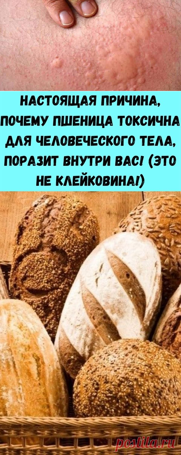 Настоящая причина, почему пшеница токсична для человеческого тела, поразит внутри вас! (Это не клейковина!) - Полезные советы красоты
