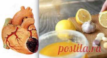 После ее инфаркта прошло уже 20 лет, но она чувствует себя прекрасно! — Journal women❜s