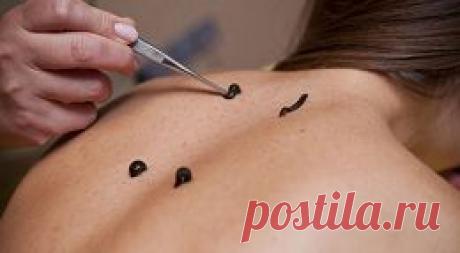 &quot;Живой шприц&quot;