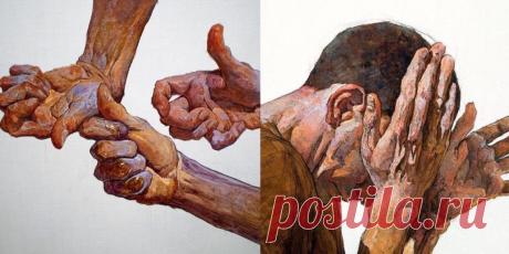 Помоги себе сам: 4 пищевые добавки при артрите, которые работают