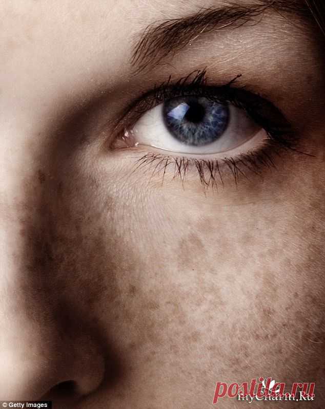 Простые советы от возрастных пигментных пятен