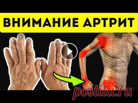 6 супер продуктов при артрите! Намажь больной участок мазью из... Воспаления суставов – это нередкое заболевание у людей, чей возраст перевалил за 40 лет, но патология может встречаться даже у детей. В этом видео мы ...