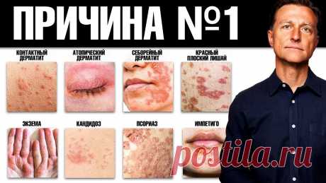 При ВСЕХ кожных заболеваниях есть дефицит этого...😲 ДИАГНОСТИКА ЗДОРОВЬЯ ПО КОЖЕ 👉 https://link.drberg.ru/8uСКАЧАТЬ БЕСПЛАТНО материалы Доктора Берга ➡️ https://link.drberg.ru/xЕсли у вас есть кожные заболева...