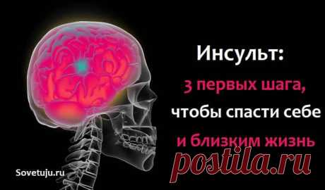 Инсульт: 3 первых шага,чтобы спасти себе и близким жизнь