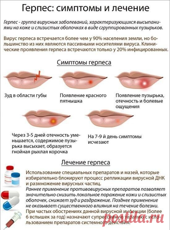 КАК ИЗБАВИТЬСЯ ОТ ГЕРПЕСА (ПРОСТУДЫ) НА ГУБЕ? 
 
Лечение герпеса на губах является непростым делом. Вот почему так важно выбрать эффективные и безопасные средства. Именно о таких народных рецептах мы и расскажем Вам в этой статье. 
 
Рецепт первый. 
 
Для лечения герпеса на губах на начальной стадии рекомендуется обрабатывать поражённые участки кожи губ каждые два – три часа эфирным маслом пихты. Если при его нанесении Вы почувствуете лёгкое жжение – не стоит пугаться, вск...