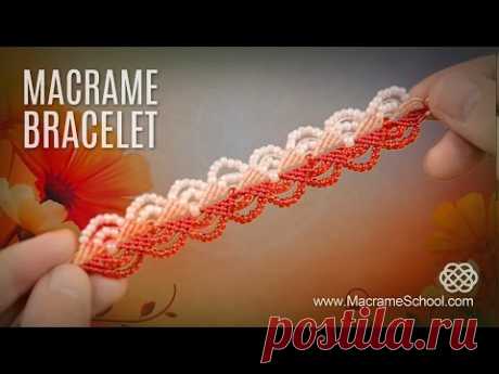 Broken Heart Bracelet (Teaser)