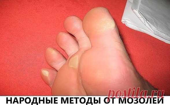 НАРОДНЫЕ МЕТОДЫ ОТ МОЗОЛЕЙ
1. Чеснок
Чеснок смягчает кожу, убивает бактерии и грибок, ведь в нём содержится природный антисептик! Раздави 3–4 зубчика чеснока, смешай их с 1 ст. л. оливкового масла и нанеси на мозоль. Лучше всего это делать на ночь в течение 7–10 дней. После нанесения чесночной пасты плотно забинтуй проблемное место.
2. Лук
Натри свежим луком или луковым соком мозоль, забинтуй ногу. Через 10 дней такой ежедневной процедуры мозоль будет очень легко удалить — грубая кожа станет т