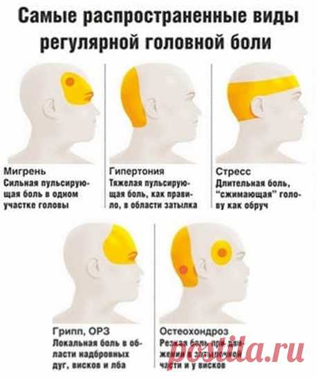 Давление или мигрень? 7 причин головной боли и что делать