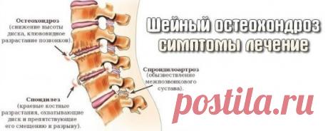 БОЛИТ ШЕЯ? КАК ШЕЙНЫЙ ОСТЕОХОНДРОЗ ВЛИЯЕТ НА НАШЕ СОСТОЯНИЕ. 
На начальном этапе изменения претерпевают кости и связки. И о том наш организм сигнализирует периодической болью или нарушением чувствительности отдела, пораженного остеохондрозом. Затем появляются трещины и меняется высота стояния диска, а точки прикрепления мышц и связок, принадлежащие двум соседним позвонкам, сближаются. 
Поэтому м