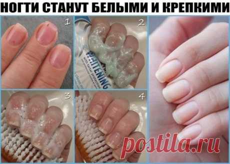 НОГТИ СТАНУТ БЕЛЫМИ И КРЕПКИМИ!
Чтобы ногти всегда выглядели ухоженными и были белыми, длинными и крепкими советую этот рецепт! Сама им пользуюсь, результат поражает!
Чтобы ногти всегда выглядели ухоженными и были белыми, длинными и крепкими советую этот рецепт! Сама им пользуюсь, результат поражает! Для этого нужно приготовить пасту, берем чайную ложку…Продолжение-
Для крепких и белых ногтей приготовьте пасту из: (все по пол чайной ложки)
- тертый картофель
- зубная паста
- перекись водорода
-