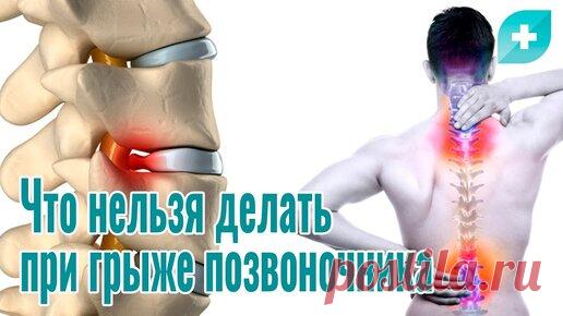 Что нельзя делать при грыже позвоночника | Первая Медицинская Клиника | Дзен