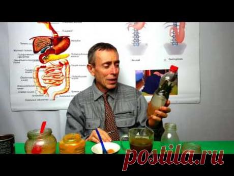 КОФЕ 2! ЛУЧШИЙ В МИРЕ РЕЦЕПТ! КОФЕ, ЗИРА, КУРКУМА  Зоб, гипотериоз, узлы, ожирение, нервозность