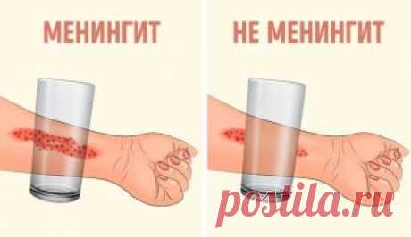 Эти 8 признаков менингита обязан знать каждый родитель! - interesno.win Менингит является заболеванием, которое поражает головной и спинной мозг. Что самое интересное,...