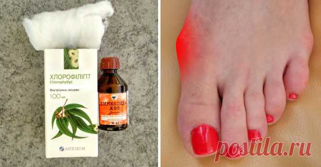 Как убрать косточку на ноге