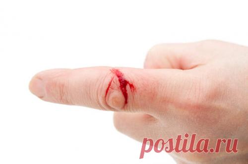 Если вы порезали палец | Хитрости Жизни