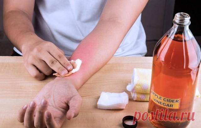 Дважды в неделю она протирала руку яблочным уксусом. Причина… Я тоже сделаю это сегодня вечером!

Следующее лекарство было отправлено нам одной из наших постоянных читательниц, которая испытывала сильную боль в руках. Копаясь в Интернете, она обнаружила способ облегчить боль и почувствовала себя намного лучше после этого средства. Попробовав различные методы, она решила обратиться к альтернативной медицине и обнаружила, что она намного эффективнее для борьбы с ее проблемой...