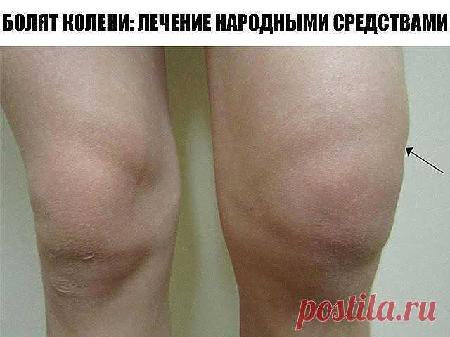 Болят коление: лечение народными средствами