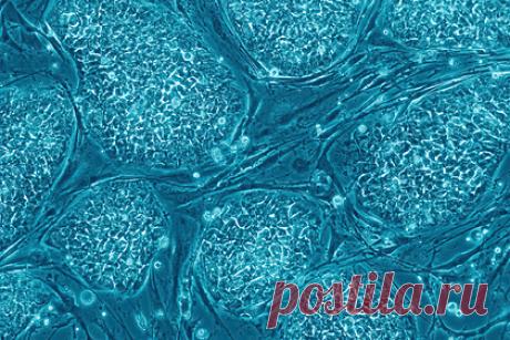 Предложен новый способ лечения геморрагического инсульта. Российские ученые разработали способ борьбы с последствиями геморрагического инсульта — опасного кровоизлияния в мозг. Исследователи предложили вводить в пораженные ткани мозга вещества, вырабатываемые мезенхимальными стволовыми клетками и способствующие регенерации.