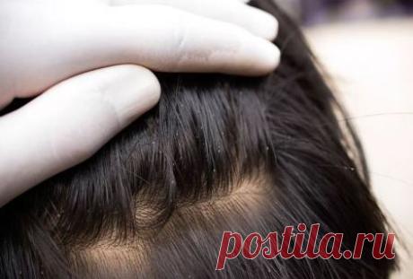 Какие есть виды вшей, их характеристики Когда человек обнаруживает на себе присутствие вшей, он сразу же начинает искать способы, как от ...
