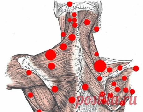 ТРИГГЕРНЫЕ ТОЧКИ - что необходимо знать? | Остеопат - Сергей Кузнецов | Яндекс Дзен