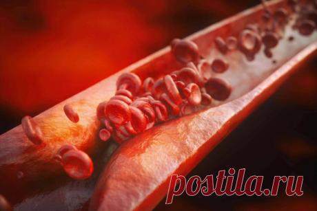 Признаки, которые с 100% точностью позволят распознать тромбы в сосудах
Тромб – это сгусток крови, который может образоваться в любой локации сосудистой системы. Тромб закупоривает сосуды, из-за чего кровоток по ним ухудшается – кровь в меньшем количестве поступает к органам и тканям, возникают дефицит питательных веществ и гипоксией (кислородным голоданием). Если тромб отрывается и мигрирует...
Читай дальше на сайте. Жми подробнее ➡