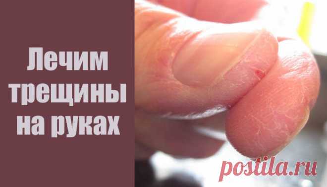 Как убрать трещины и шероховатость на руках