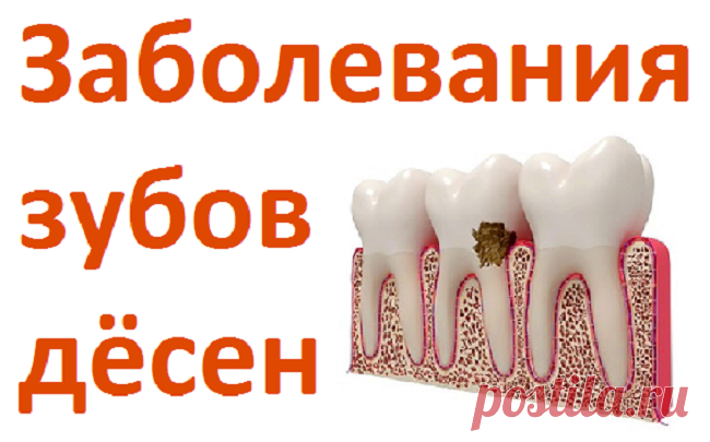 Заболевания зубов, дёсен и народные средства при зубной боли | Советы целительницы