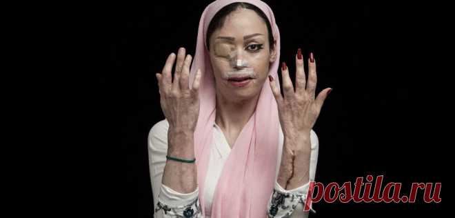 10 впечатляющих снимков-победителей конкурса Sony World Photography Awards