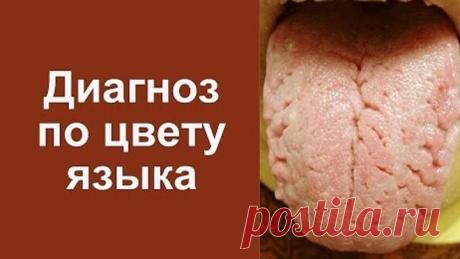 Как определить диагноз болезни по цвету языка - Академия здоровья