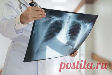 Найдена причина многомесячной одышки после COVID-19. Британские медики нашли причину постковидного синдрома, вызывающего многомесячную одышку у части пациентов, которые переболели COVID-19. Авторы исследования предполагают, что COVID-19 приводит к микроскопическим повреждениям легких, которые можно заметить лишь при магнитно-резонансной томографии с ксеноном.