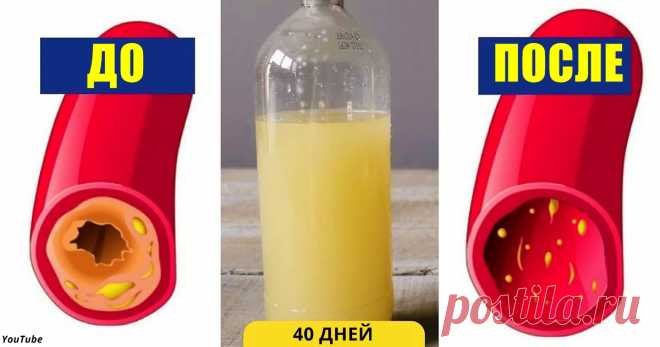 Вот как вычистить сосуды от холестерина за 40 дней без единого лекарства - Хитрости Жизни - медиаплатформа МирТесен
