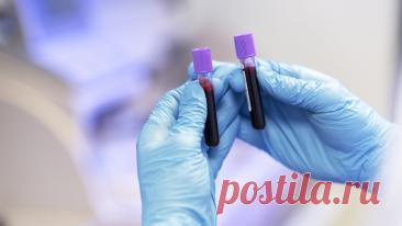 Врач развеяла популярный миф об общем анализе крови Daily Mirror: по общему анализу крови невозможно выявить рак.