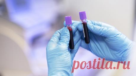 Врач развеяла популярный миф об общем анализе крови Daily Mirror: по общему анализу крови невозможно выявить рак.