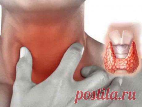 Простой (нетоксический) зоб  (код МКБ-10; код МКБ-11): описание, причины, симптомы, как лечить | Клиника лечения боли: врачи онлайн